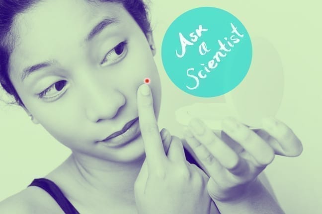 Ask a Scientist: Does Toothpaste Get Rid of Zits? | YouBeauty